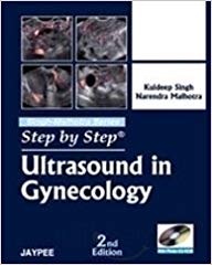 Ultrasound in Gynecology (Step by Step)