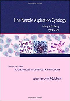 Fine Needle Aspiration Cytology: A Volume in Foundations in Diagnostic Pathology
