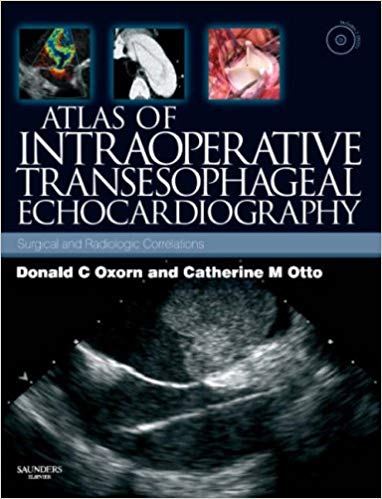 Atlas of Intraoperative Transesophageal  Echocardiography: Surgical and Radiologic Correlations, Text with DVD