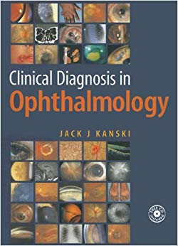Clinical Diagnosis in Ophthalmology