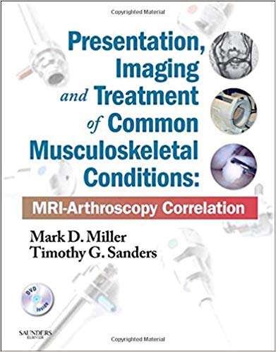 Presentation, Imaging and Treatment of Common Musculoskeletal Conditions: MRI-Arthroscopy Correlation (Expert Consult - Online and Print)