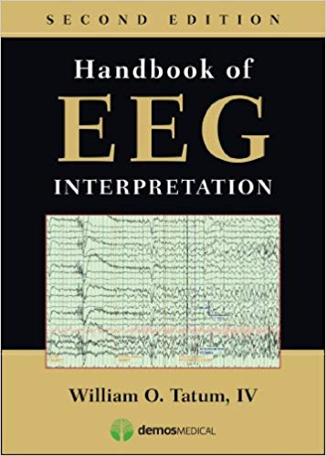 Handbook of EEG Interpretation, Second Edition