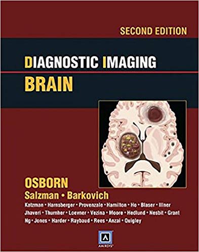 Diagnostic Imaging: Brain: Published by Amirsys