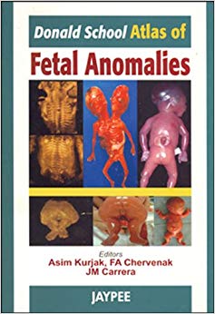 Donald School: Atlas of Fetal Anomalies