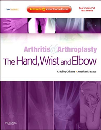 Arthritis and Arthroplasty: The Hand, Wrist and Elbow: Expert Consult - Online, Print and DVD
