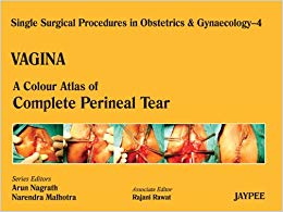 Vagina: A Colour Atlas of Complete Perineal Tear (Single Surgical Procedures in Obstetrics & Gynaecology)