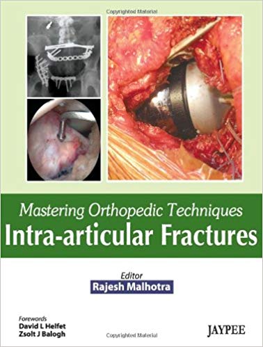 Mastering Orthopedic Techniques: Intra-articular Fractures