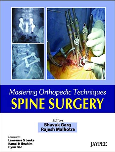 Spine Surgery (Mastering Orthopedic Techniques)