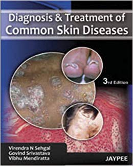 Diagnosis and Treatment of Common Skin Diseases