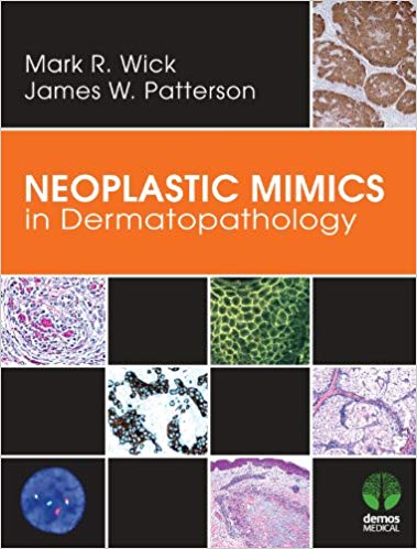 Neoplastic Mimics in Dermatopathology (Pathology of Neoplastic Mimics)