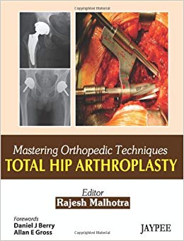 Total Hip Arthroplasty (Mastering Orthopedic Techniques)