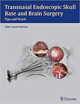 Transnasal Endoscopic Skull Base and Brain Surgery: Tips and Pearls