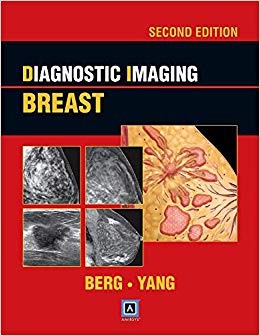 Diagnostic Imaging: Breast, 2nd ed: Published by Amirsys