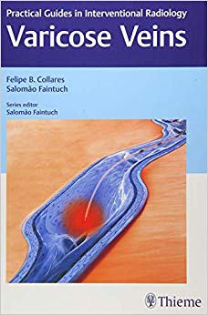 Varicose Veins: Practical Guides in Interventional Radiology