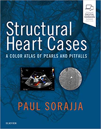 Structural Heart Cases: A Color Atlas of Pearls and Pitfalls