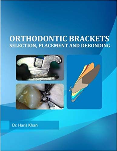 Orthodontic Brackets: Selection,Placement and Debonding