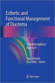 Esthetic and Functional Management of Diastema: A Multidisciplinary Approach