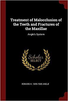 Treatment of Malocclusion of the Teeth and Fractures of the Maxillae: Angle
