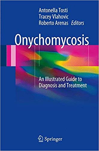 Onychomycosis: An Illustrated Guide to Diagnosis and Treatment