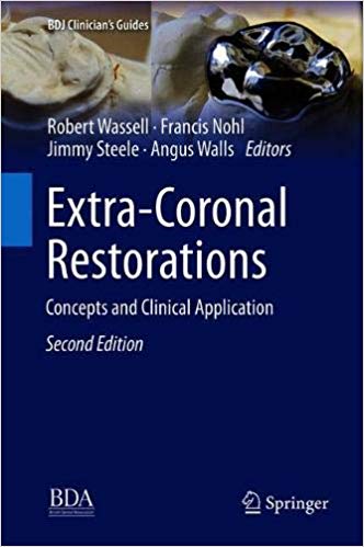 Extra-Coronal Restorations: Concepts and Clinical Application (BDJ Clinician’s Guides)