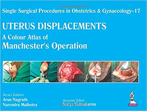 Uterus Displacements: A Colour Atlas of Manchester