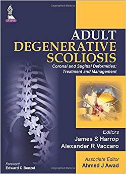 Adult Degenerative Scoliosis: Coronal and Sagittal Deformities: Treatment and Management