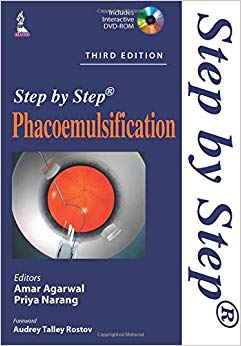 Phacoemulsification (Step by Step)