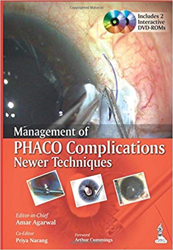 Management of Phaco Complications: Newer Techniques
