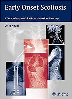 Early Onset Scoliosis: A Comprehensive Guide from the Oxford Meetings