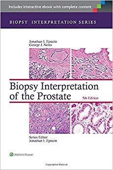 Biopsy Interpretation of the Prostate (Biopsy Interpretation Series)
