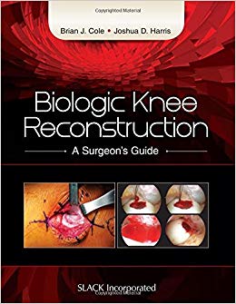 Biologic Knee Reconstruction: A Surgeon