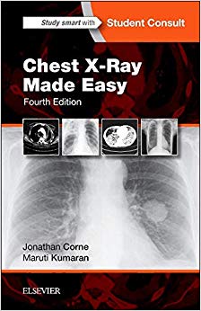 Chest X-Ray Made Easy