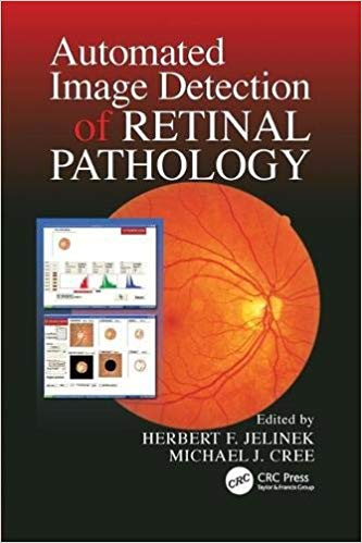 Automated Image Detection of Retinal Pathology
