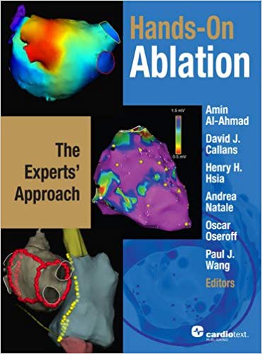 Hands-on Ablation: The Experts