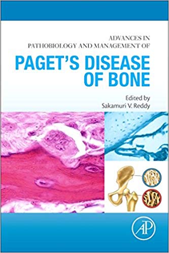Advances in Pathobiology and Management of Paget’s Disease of Bone