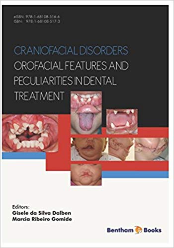 Craniofacial disorders – orofacial features and peculiarities in dental treatment