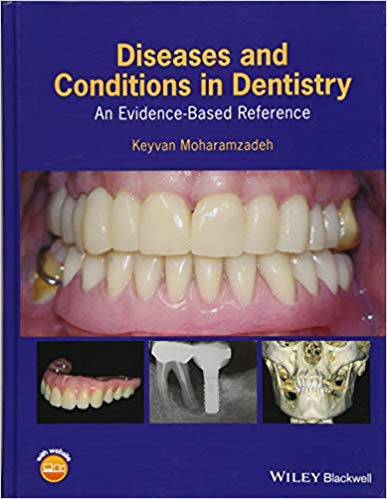 Diseases and Conditions in Dentistry: An Evidence-Based Reference