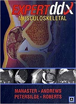 EXPERTddx: Musculoskeletal: Published by Amirsys® (EXPERTddx (TM))