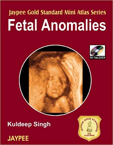 Fetal Anomalies with Photo CD-ROM Jaypee Gold Standard Mini Atlas (Jaypee Gold Standard Mini Atlas Series)