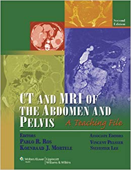 CT and MRI of the Abdomen and Pelvis: A Teaching File (LWW Teaching File Series), 2e