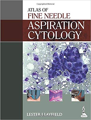 Atlas of Fine Needle Aspiration Cytology