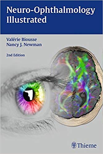 Neuro-Ophthalmology Illustrated
