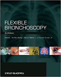 Flexible Bronchoscopy