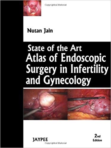 State of the Art Atlas of Endoscopic Surgery in Infertility and Gynecology, 2/E