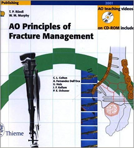 AO Principles of Fracture Management (Book with CD-ROMs + DVD)