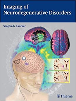 Imaging of Neurodegenerative Disorders