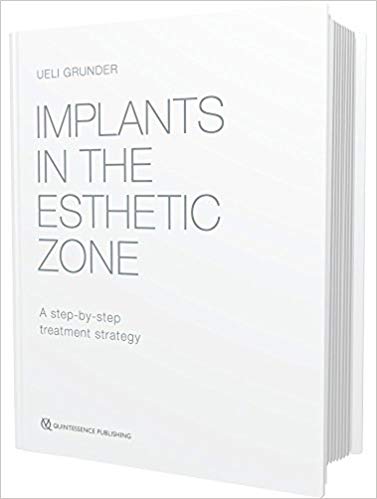 Implants in the Esthetic Zone: A Step-by-Step Treatment Strategy