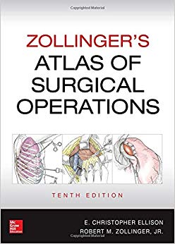 Zollinger