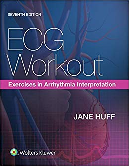 ECG Workout: Exercises in Arrhythmia Interpretation