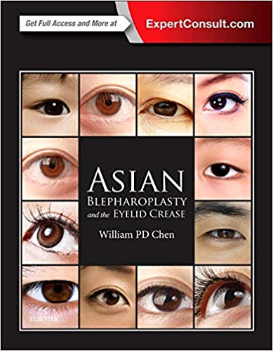 Asian Blepharoplasty and the Eyelid Crease